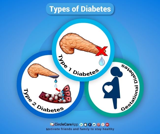 Things You Should Know About Diabetes