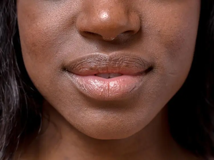 DIY Natural Remedies for Dry Skin and Cracked Lips